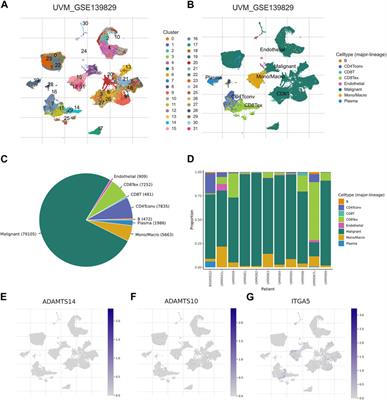 Decoding tumor heterogeneity in uveal melanoma: basement membrane genes as novel biomarkers and therapeutic targets revealed by multi-omics approaches for cancer immunotherapy